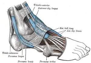 Peroneal Tendonitis – What is it? 
