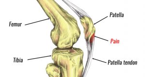 knee pain after exercises