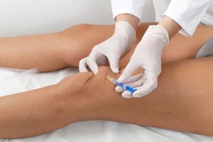 hyaluronic acid injections in knee 