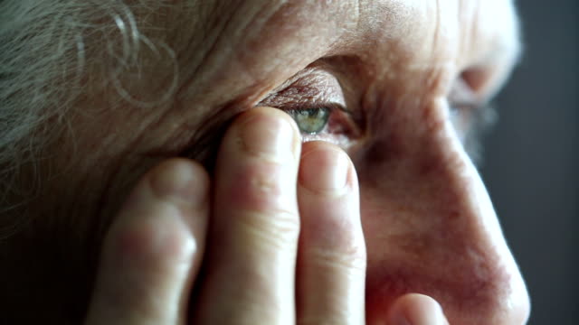 dry eyes arthritis